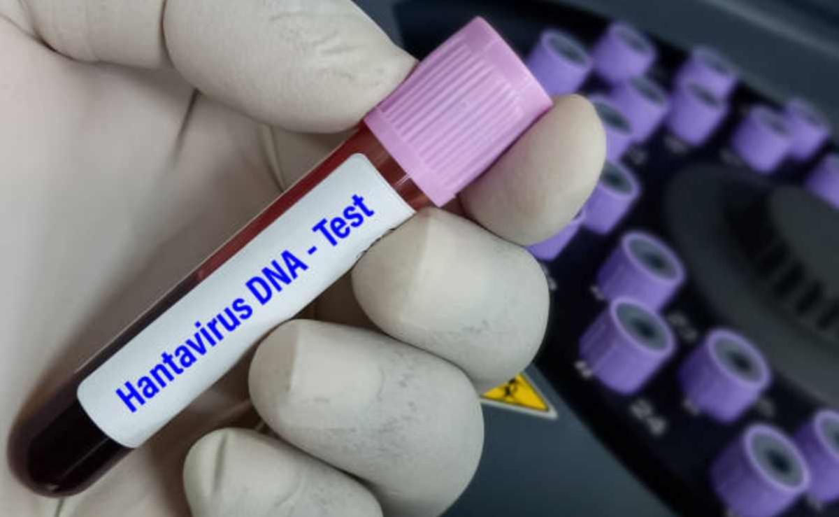 Que-es-el-hantavirus-y-como-se-transmite-claves-tras-el-brote-en-el-crucero-MV-Hondius